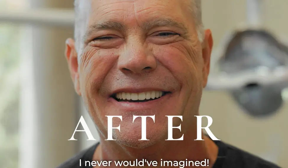 A Lasting Solution for Your Smile