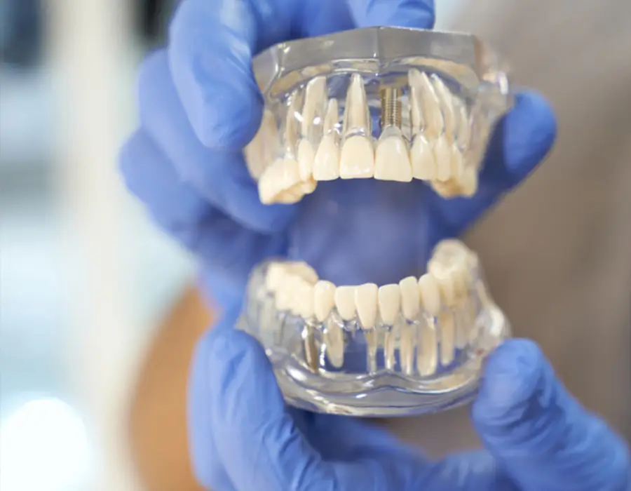 Benefits of Teeth-In-A-Day