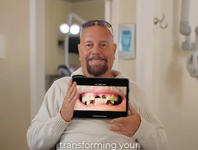 Benefit from Teeth Whitening